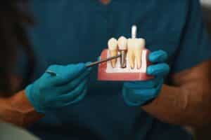 Dental professional illustrating a dental implant procedure on a model during a patient consultation.